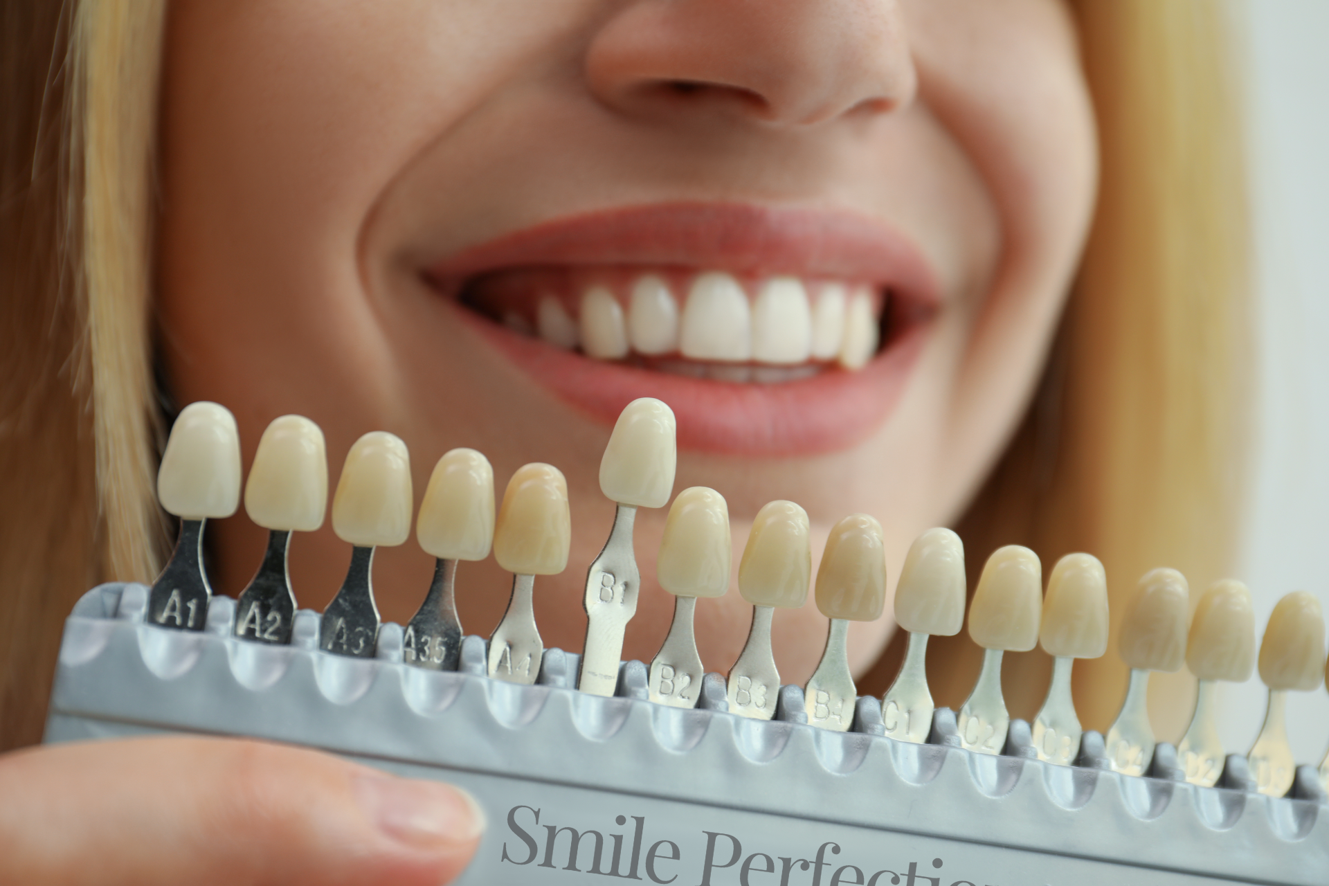 Close-up of a woman's tooth shade comparison using a color palette for veneer matching at Smile Perfection in Livingston, NJ.